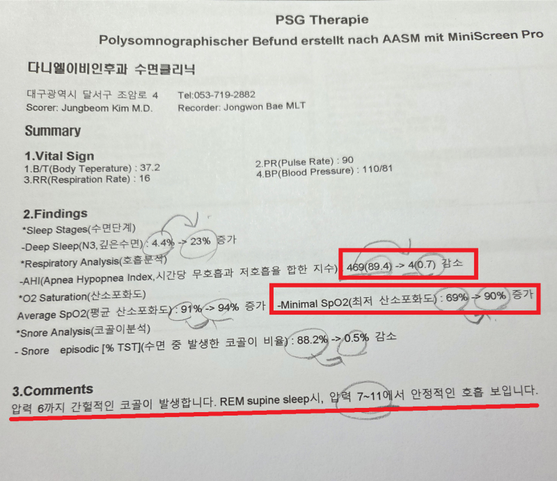임산부 코골이 수면무호흡 수면다원검사 양압기 정보
