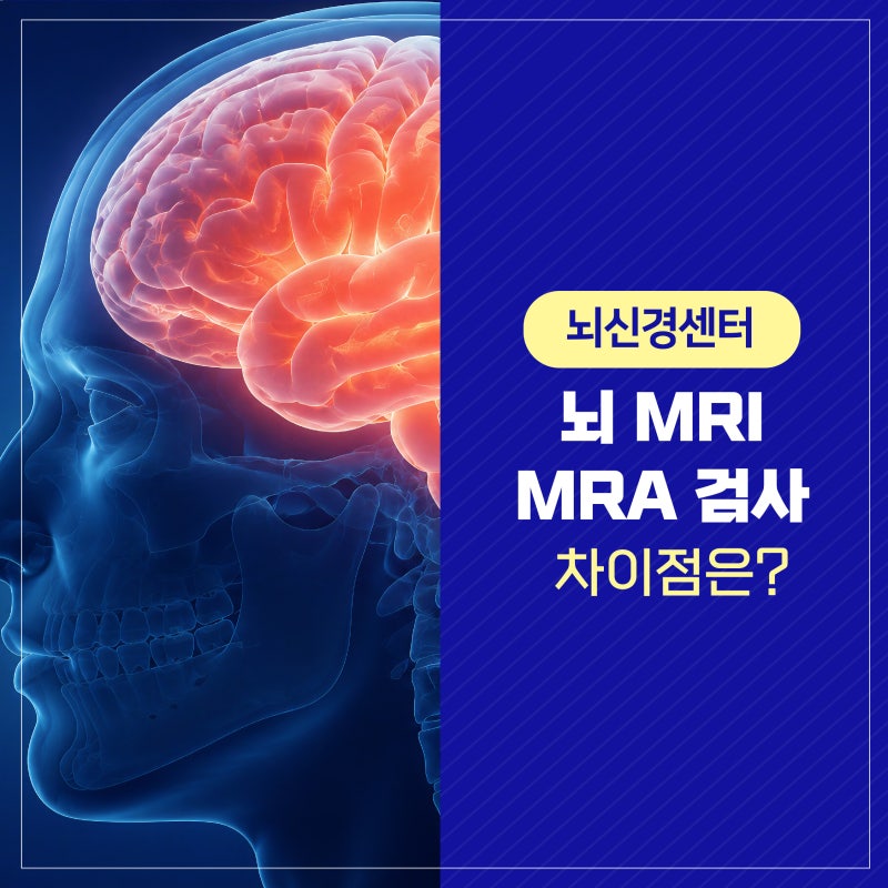 뇌 MRI MRA 차이점은? 어떤 검사를 받아야 할까