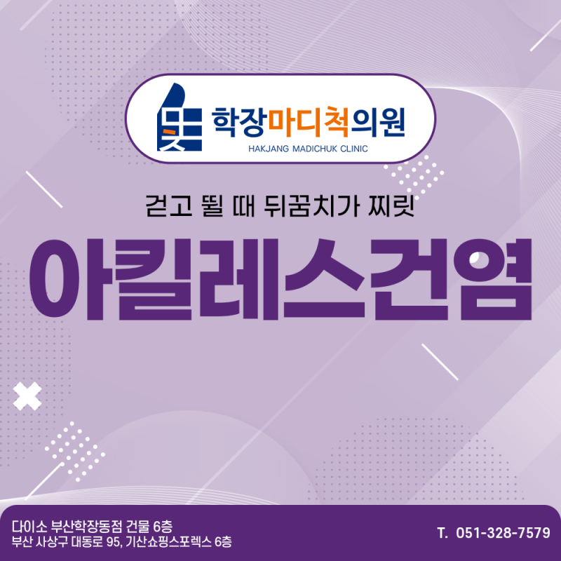 감전동아킬레스건염 통증과 붓기 줄이는 5가지 방법