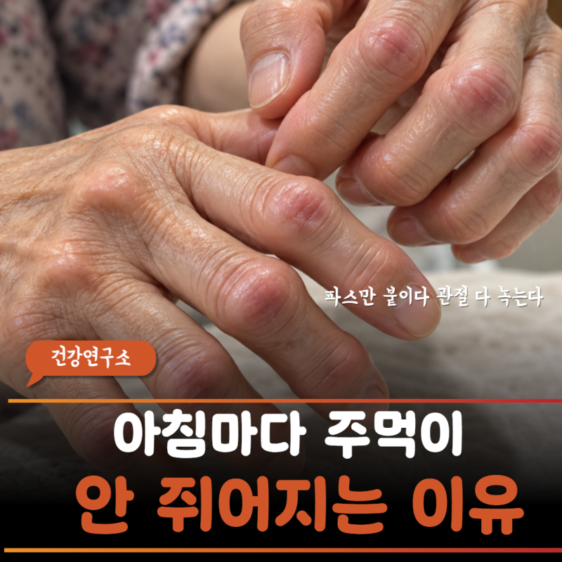 살림 많이 해서 손가락 굳는 줄 알았는데… 류마티스 관절염 조기 진단과 조조강직 체크포인....