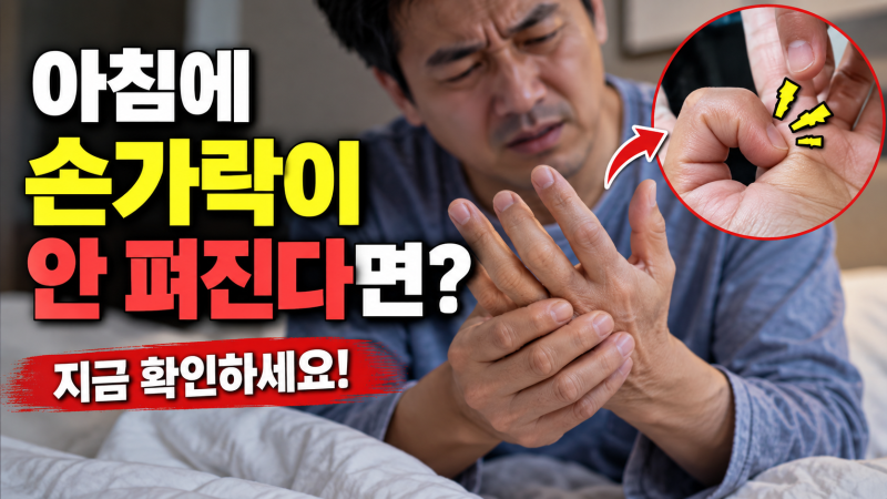 아침 손가락이 뻣뻣할 때 30분을 재보세요｜방아쇠수지·류마티스·퇴행성관절염 구별법
