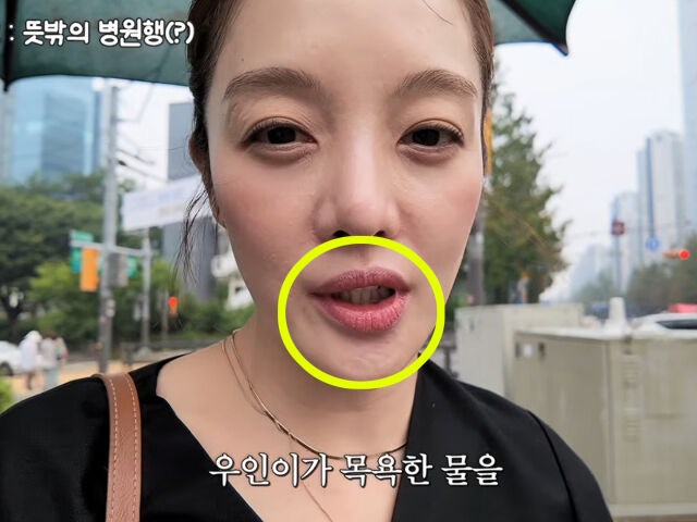 배우 황보라, 사라진 교정기 논란의 진실.. 보여주기식이었나?
