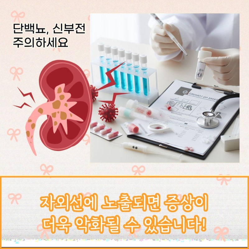 경기 안산 루푸스병 기본정보 궁금하다면 꼭 알아두어야 할 내용