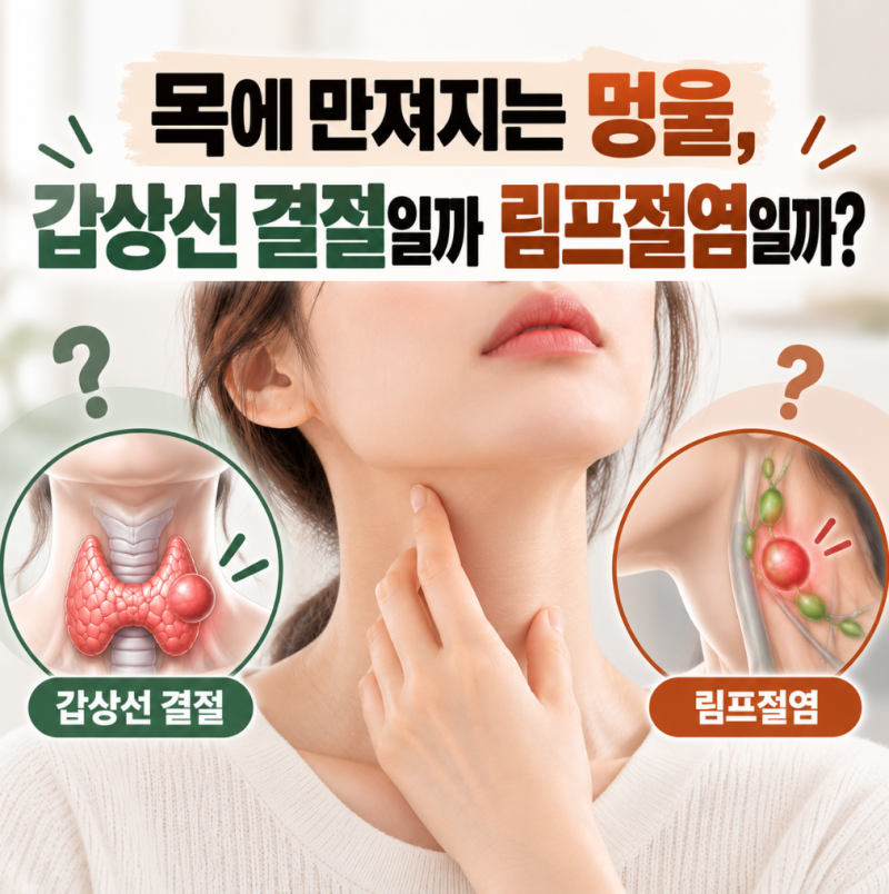 목에 만져지는 멍울, 갑상선 결절일까 림프절염일까?