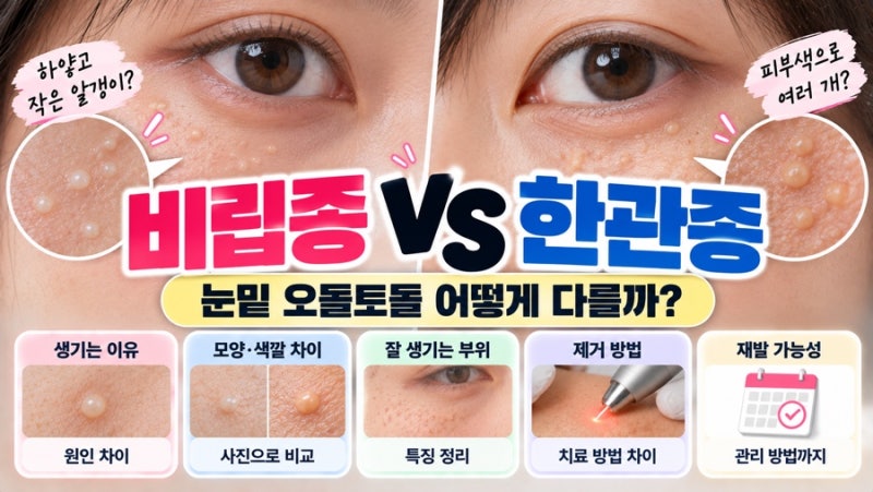비립종 vs 한관종 차이｜눈밑 오돌토돌 어떻게 다를까?
