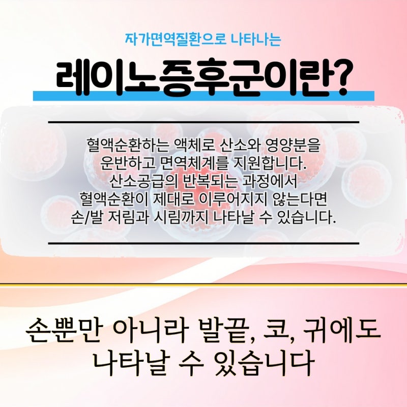 경기 용인시 발 저림이 지속될 때 레이노증후군일 수 있어요