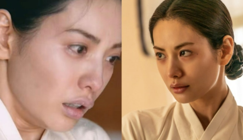나나 입술 필러 논란 사과…“배우로서 잘못된 판단”