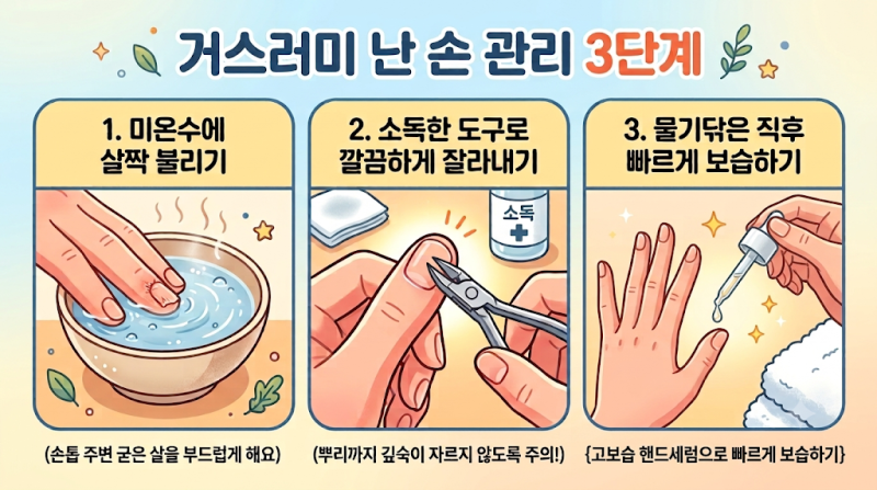 손톱 옆이 자꾸 일어나는 이유? 손거스러미 원인과 다시 생기지 않게 하는 습관