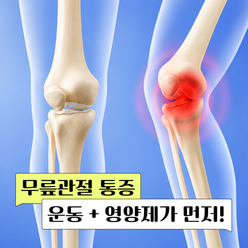 무릎관절통증 치료와 약이 우선? 운동과 영양제를 병행한 관리 방법