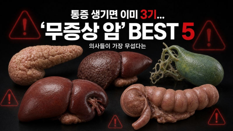 통증 생기면 이미 3기... 의사들이 가장 무섭다는 '무증상 암' BEST 5