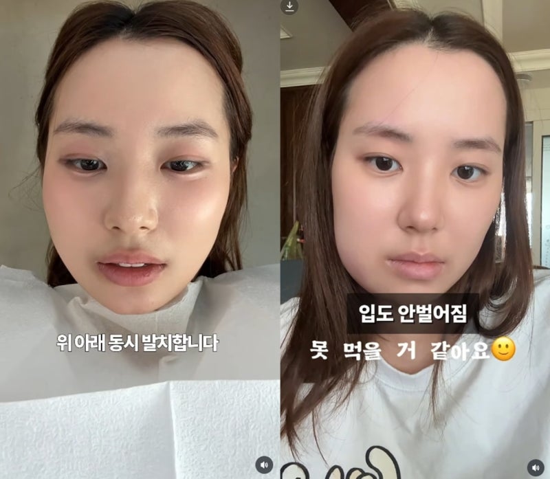 결혼기념일 까먹고 사랑니까지 뽑은 최현석 딸 최연수, 남편 김태현 반응이 궁금한 이유
