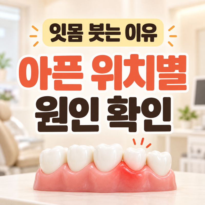잇몸 붓는 이유 무엇일까? 피나고 아픈 위치별 원인 확인