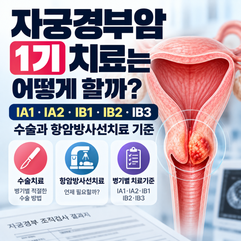자궁경부암 1기 치료는 어떻게 할까? IA1·IA2·IB1·IB2·IB3 수술과 항암방사선치료 기준
