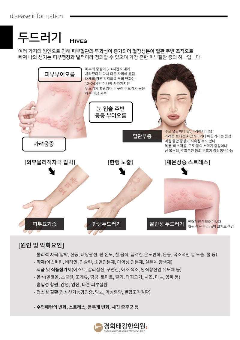 항히스타민제, 오래 먹어도 괜찮을까요? 알레르기약 효과와 1세대·2세대 차이·장기복용·졸....
