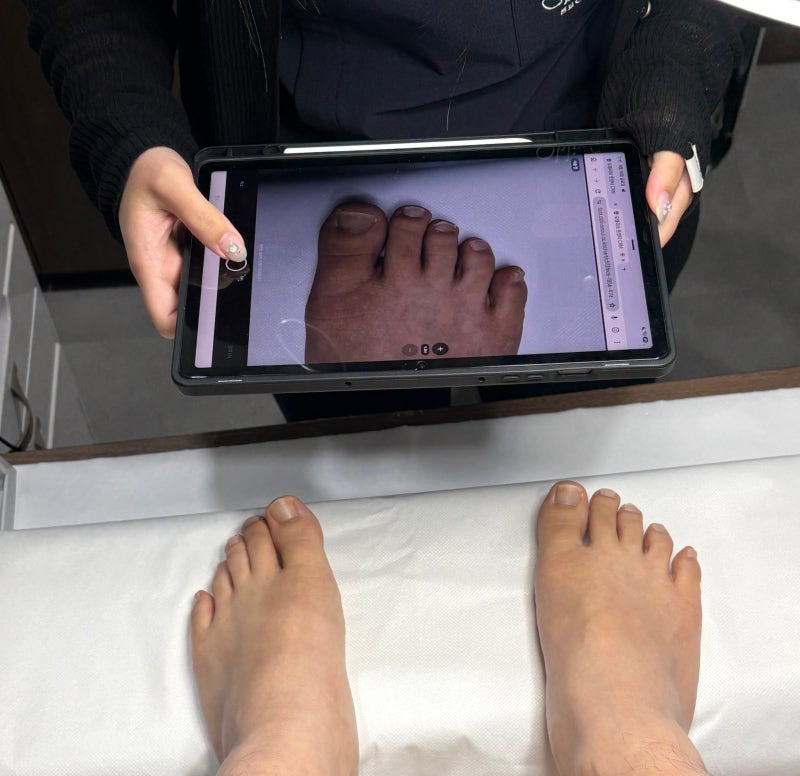 종로3가 문제성발톱 전문 병원 내돈내산! / 관리 아닌 치료 받아본 솔직 후기, 결과는 대만족....
