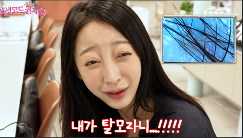 EXID 혜린 "내가 탈모라니".. 하루 탈색 6번, 줄어든 머리숱 빠진 걸까 끊어진 걸까