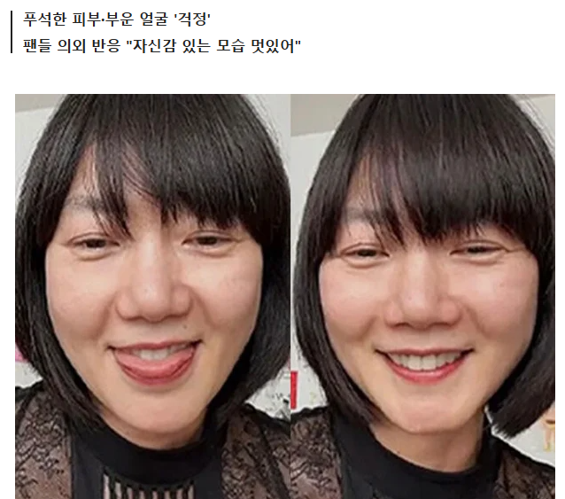 배두나, 동안 얼굴에 찾아온 급속 노화…'달덩이'처럼 부은 모습에 건강 걱정