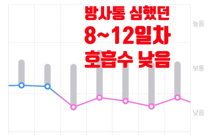 [D+15] 성인 편도 제거 수술 후기(2박3일 전신마취 전절제)