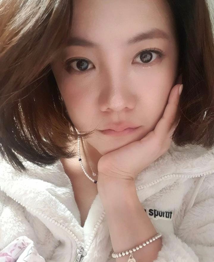 고은아, ‘중형차 한 대 값’ 9시간 코 수술 후…달라진 최근 모습 공개