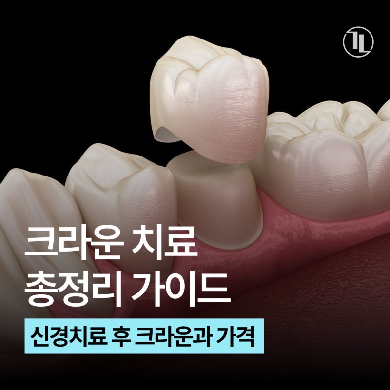 크라운 치료 가이드 / 충치·신경치료 후 크라운과 가격&보험 / 강남레옹치과