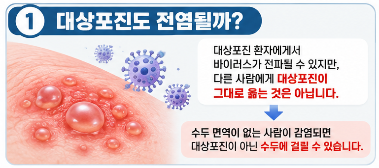 대상포진전염성 있을까? 전염기간·가족 감염·예방법 총정리