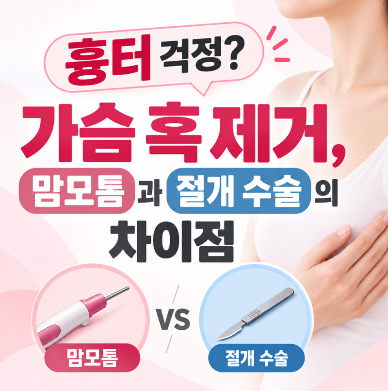 흉터 걱정 줄인 가슴 혹 제거, 맘모톰과 절개 수술의 차이점