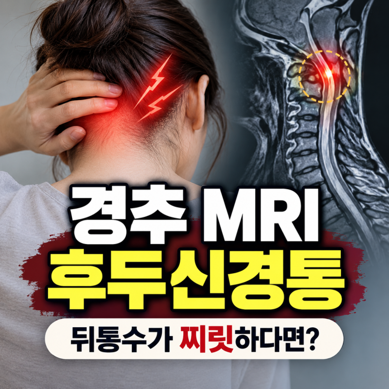 경추 MRI 후두신경통, 뒤통수가 찌릿하다면 확인해야 할 이유