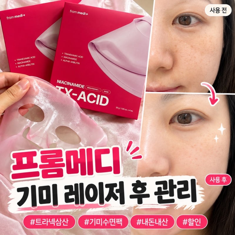 트라넥삼산 기미수면팩 내돈내산 기미레이저 후 관리 추천