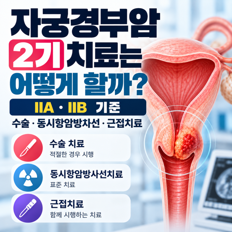 자궁경부암 2기 치료는 어떻게 할까? IIA·IIB 수술·동시항암방사선·근접치료 기준