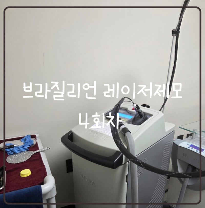 광주 브라질리언레이저제모 4회차, 부작용 후기