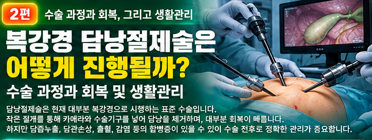 복강경 담낭절제술 어떻게 진행될까 수술 과정과 회복 관리