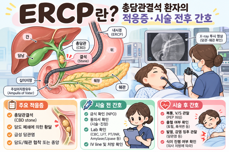 ERCP란? 총담관결석 환자 보내고 공부한 적응증·시술 전후 간호