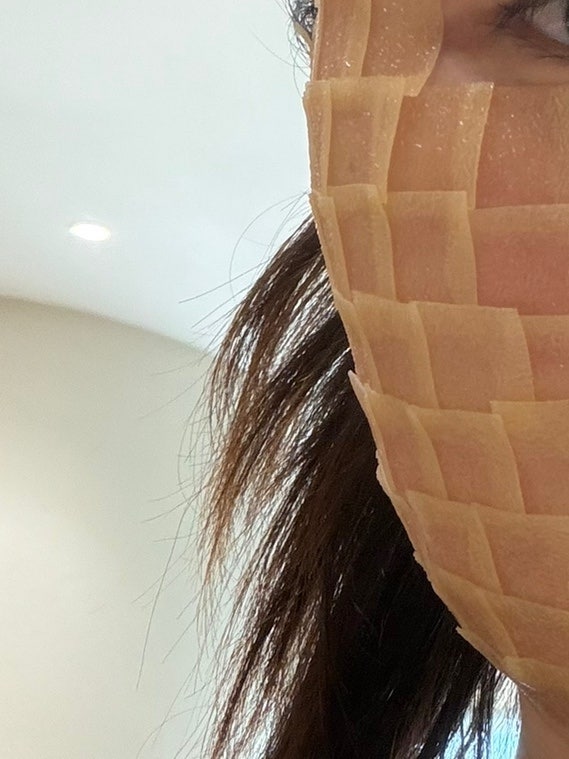 합정 연세보드미의원 편평사마귀 280개 제거 후기(편평사마귀 성지,예약방법,가격,당일후기)