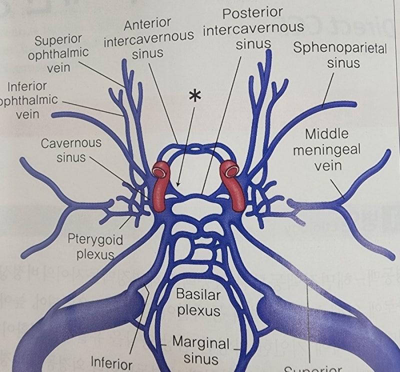 뇌혈관 기형, ④ 해면상 혈관기형 / 해면혈관종(CCM, Cerebral Cavernous Malformation / CM, Cavernous Malform....