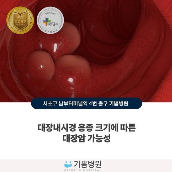 대장내시경 용종 크기별 대장암 가능성과 안전한 예방법 Q&A