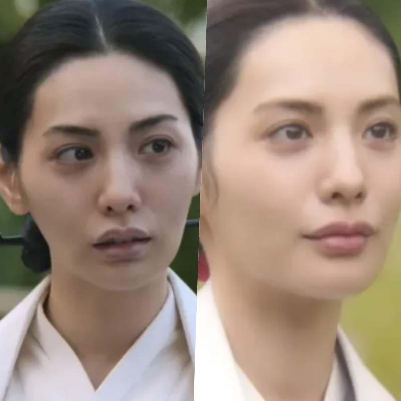 나나, 캐스팅 논란 이어 입술 필러 의혹까지? 결국.. 사과