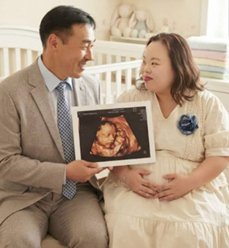 "초음파 사진이 왜 이렇게 크지?" 서은혜 조영남 초음파 공개 사진 한 장에 추측 이어진 이유