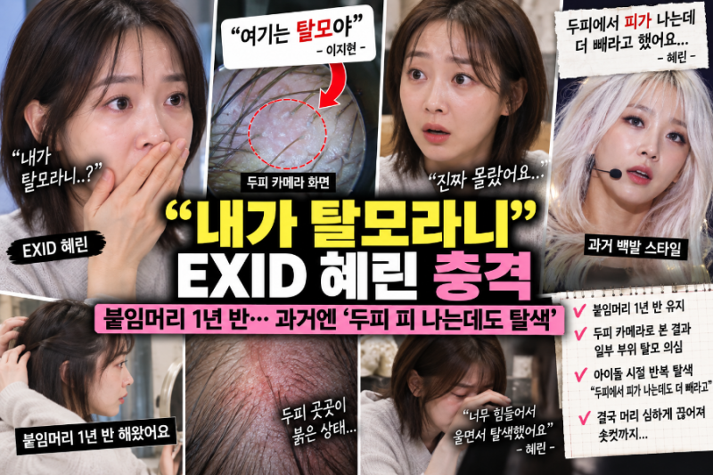 내가 탈모라니” EXID 혜린 충격…붙임머리 1년 반, 과거엔 ‘두피 피 나는데도 탈색’