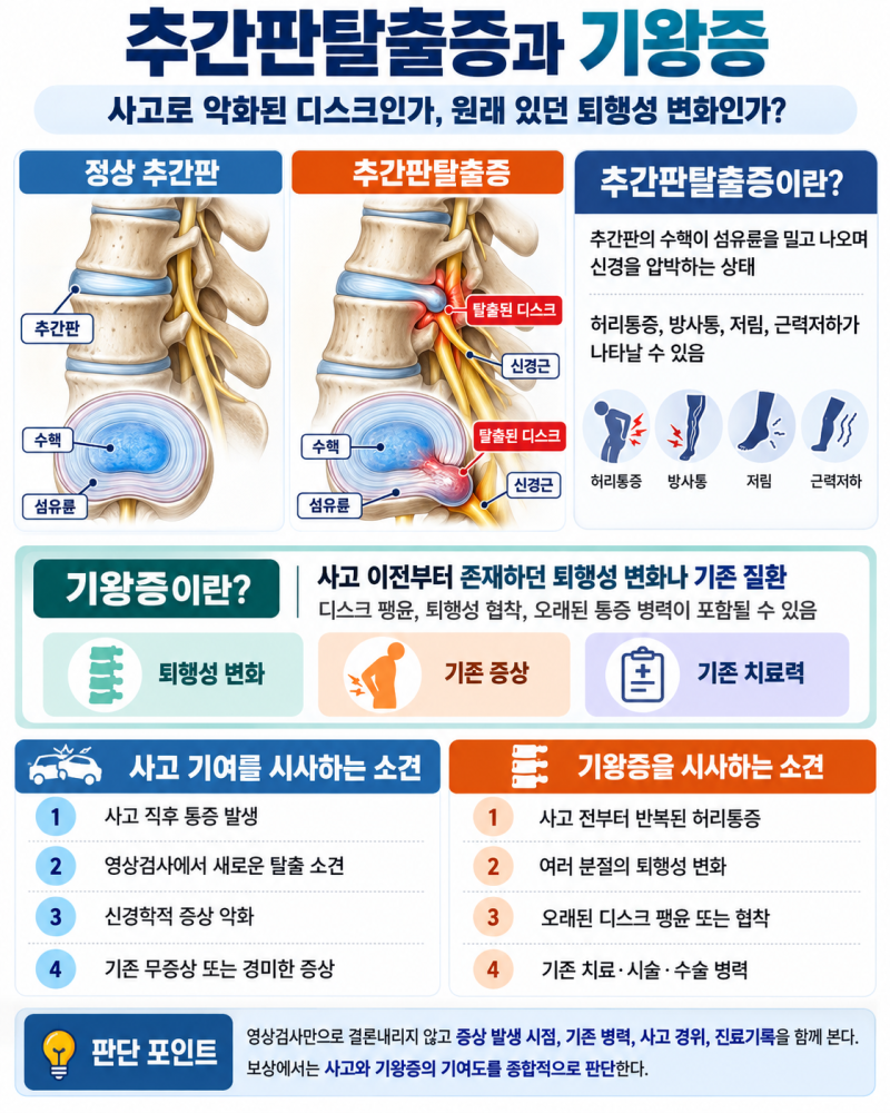 추간판탈출증 교통사고 보상, 기왕증 50% 공제는 정답일까?_Prepared by 서호석손해사정사