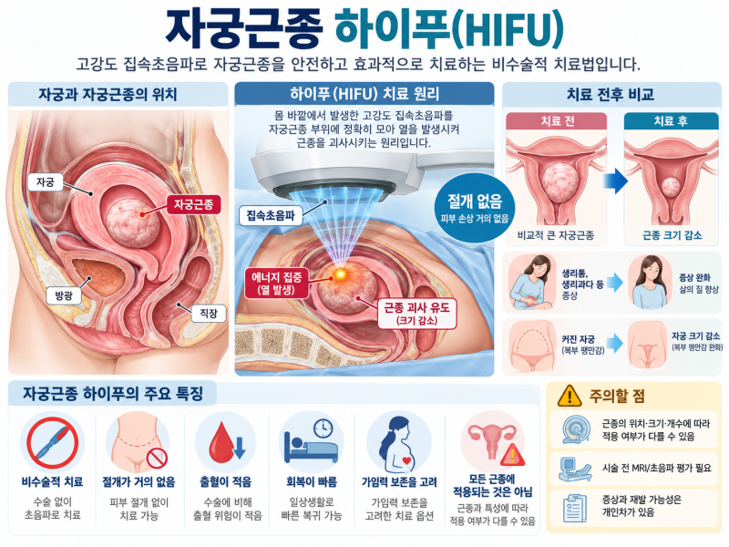 자궁근종 하이푸(HIFU), 진료지침에 맞지 않으면 실손보험금도 거절될까?