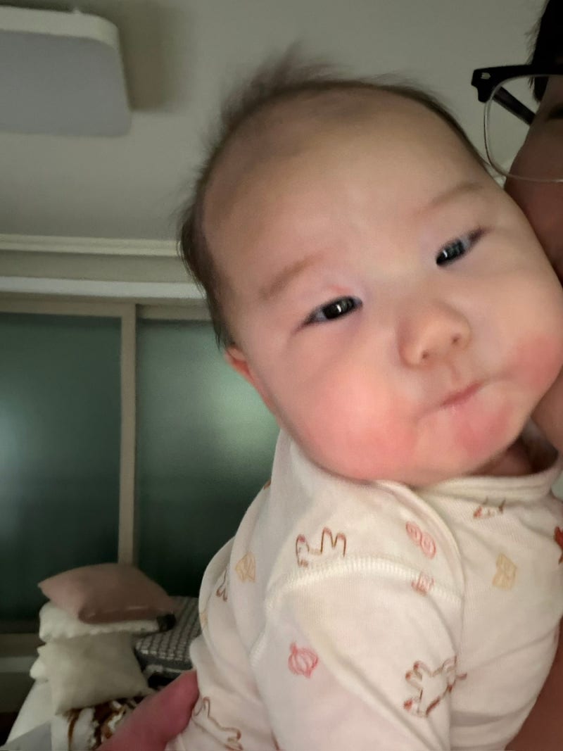 아기 입 주변 붉은 반점? 침독 원인부터 관리법, 연고까지