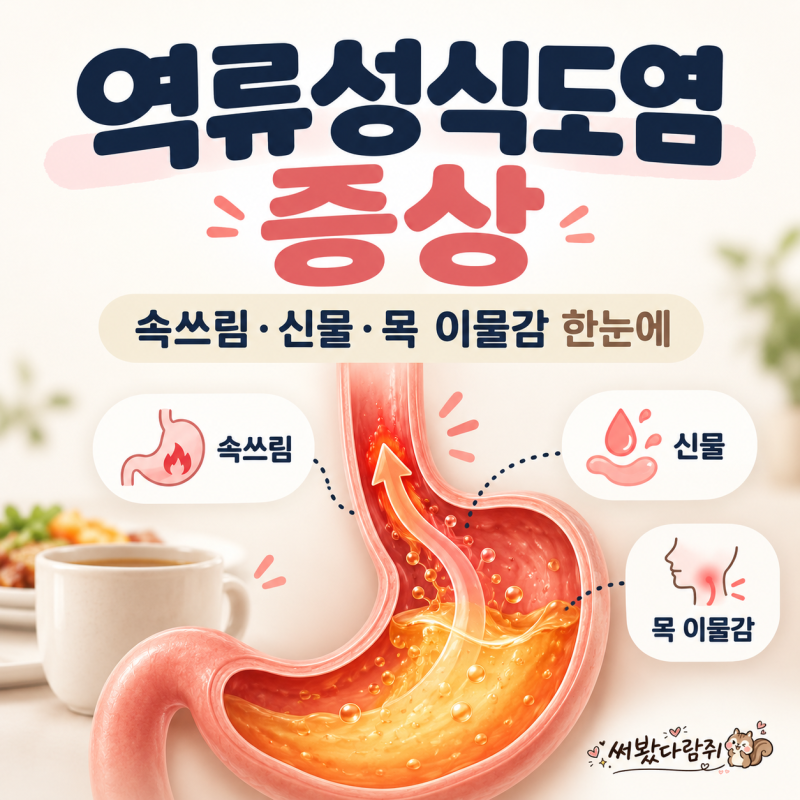 역류성식도염 증상은? 속쓰림부터 목 이물감·기침까지 확인해요