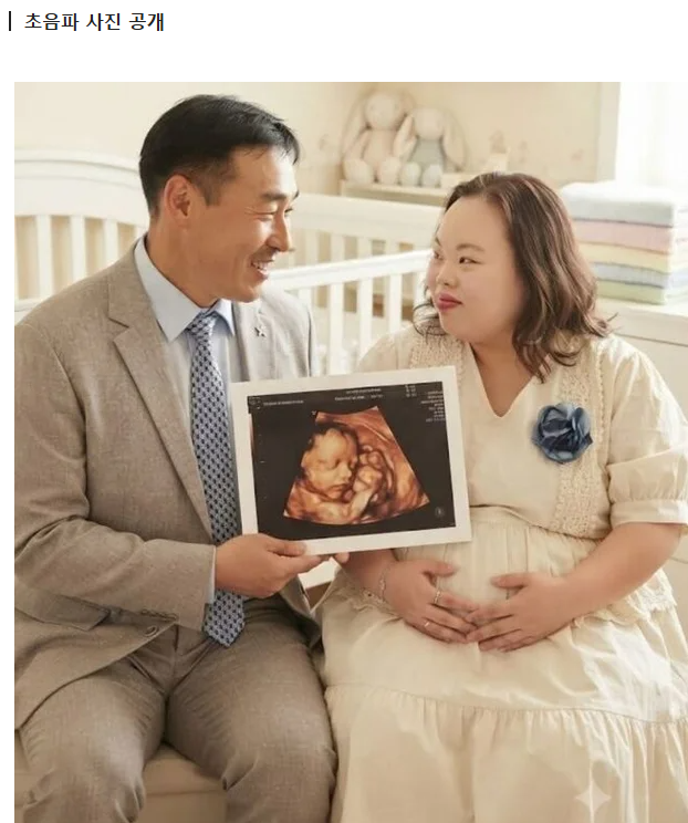 [속보]'다운증후군 작가' 서은혜♥ 조영남, 전격 임신 발표