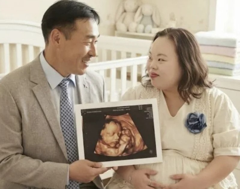 서은혜 임신설 사실 아니었다…조영남과 초음파 사진은 AI 이미지, 두 사람이 밝힌 2세 계획
