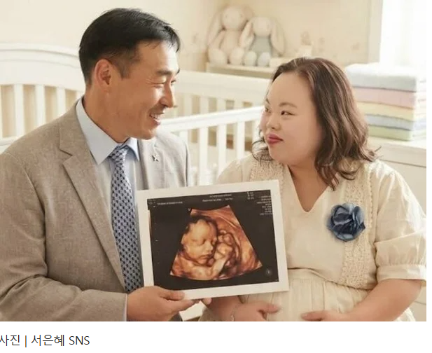 '다운증후군 작가' 서은혜, 임신 소식에 쏟아진 '못된 댓글' 눈살