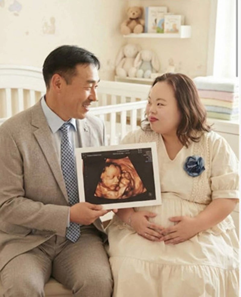 서은혜 다운증후군 작가 임신설, 아버지 "AI 생성 이미지, 사실무근" 직접 부인