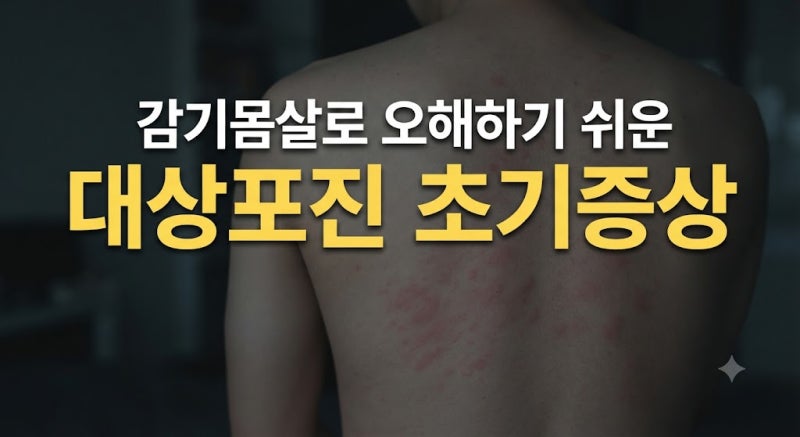 대상포진 초기증상, 몸살일까? 감기몸살과 헷갈리는 초기 전조증상 총정리