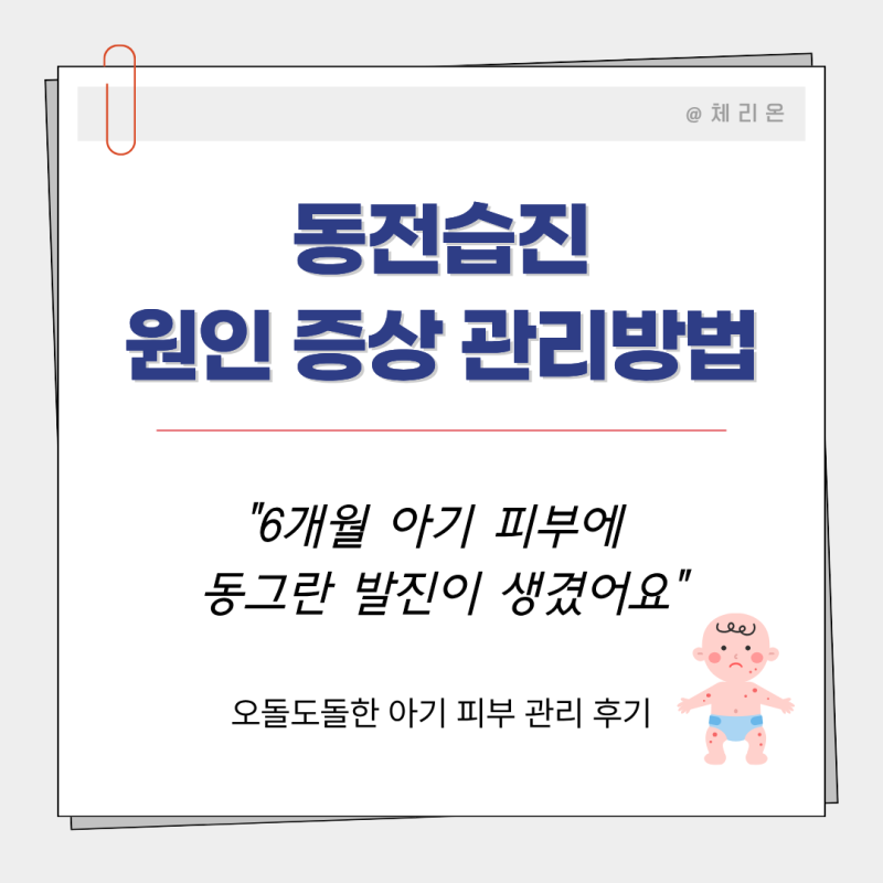 땀띠? 발진? 아기 동전습진 (증상 원인 관리방법)