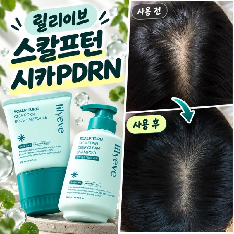 지루성 두피염에 좋다길래 써봄｜릴리이브 스칼프턴 시카 PDRN 라인 2주 사용후기