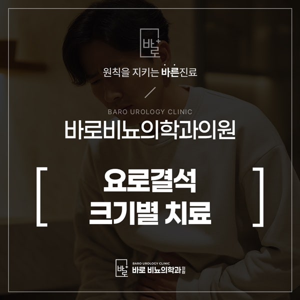 요로결석 크기별 치료 ㅡ 체외충격파쇄석술과 요관내시경제거술